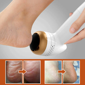 Electronic Foot File