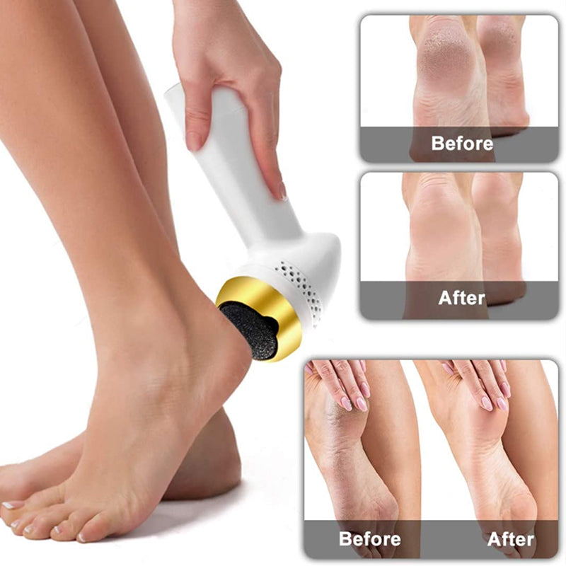 Electronic Foot File