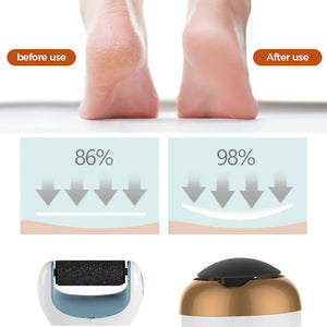 Electronic Foot File